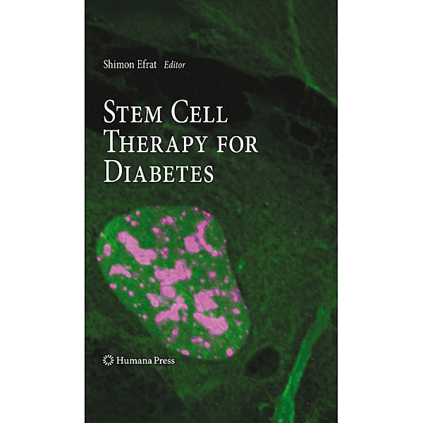 Stem Cell Therapy for Diabetes