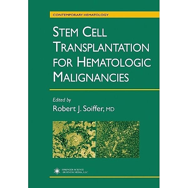 Stem Cell Transplantation for Hematologic Malignancies / Contemporary Hematology, Robert J. Solffer