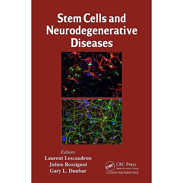 Stem Cells and Neurodegenerative Diseases