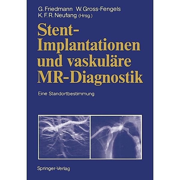 Stent-Implantationen und vaskuläre MR-Diagnostik