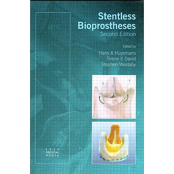 Stentless Bioprostheses, Hans A Huysmans, Stephen Westaby, Tirone E David