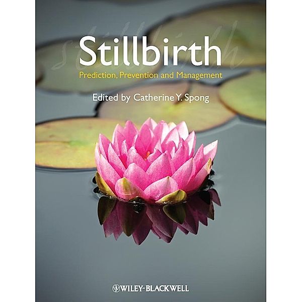 Stillbirth