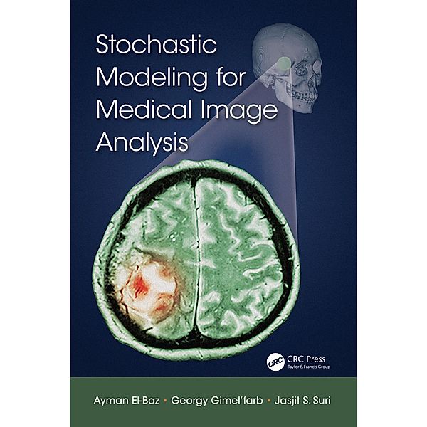 Stochastic Modeling for Medical Image Analysis, Ayman El-Baz, Georgy Gimel'farb, Jasjit S. Suri