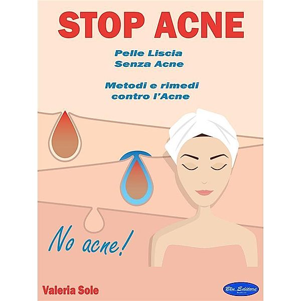 Stop Acne, Valeria Sole