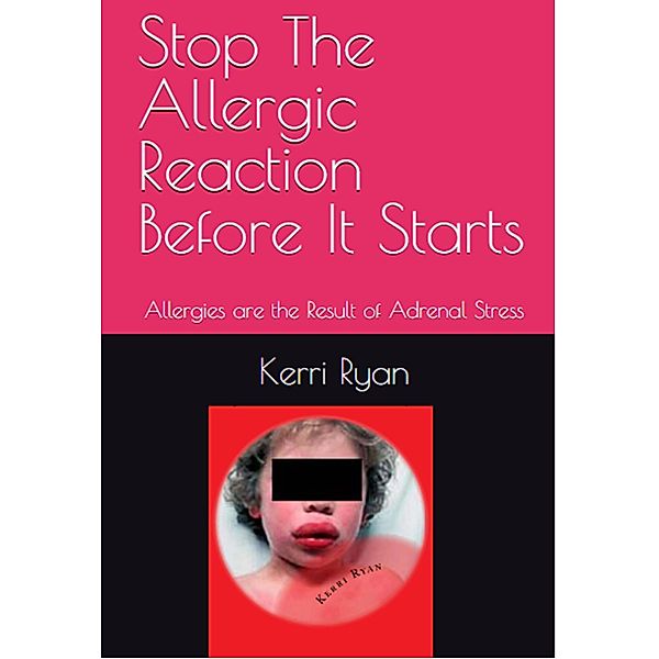 Stop the Allergic Reaction Before It Starts, Kerri Ryan