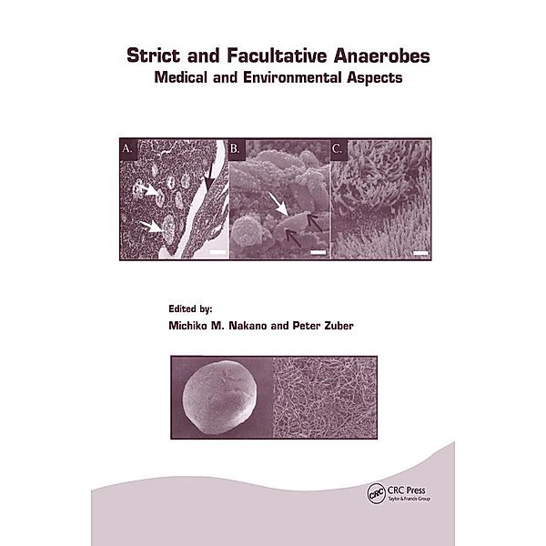 Strict and Facultative Anaerobes