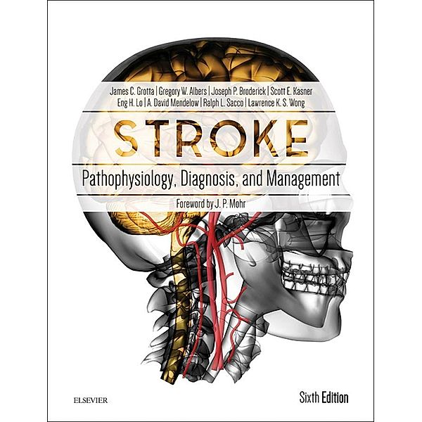 Stroke E-Book, A David Mendelow