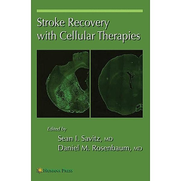 Stroke Recovery with Cellular Therapies