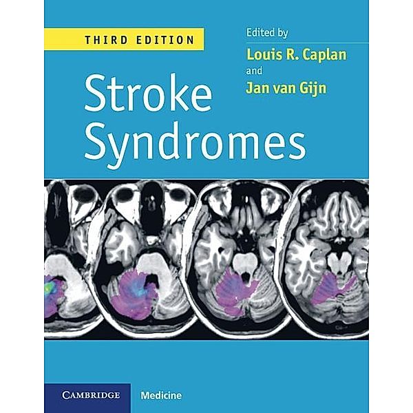 Stroke Syndromes, 3ed