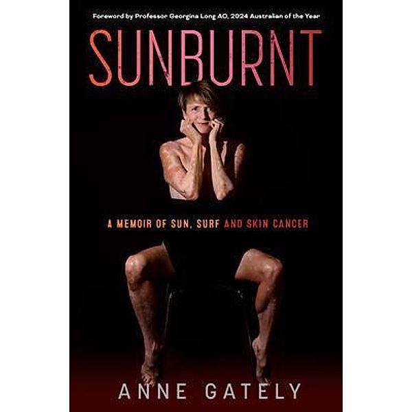 SUNBURNT, Anne Gately