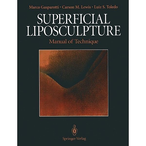 Superficial Liposculpture, Marco Gasparotti, Carson M. Lewis, Luiz S. Toledo