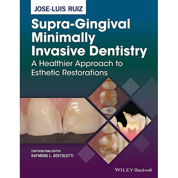 Supra-Gingival Minimally Invasive Dentistry, Jose-Luis Ruiz