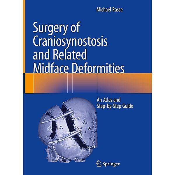 Surgery of Craniosynostosis and Related Midface Deformities, Michael Rasse