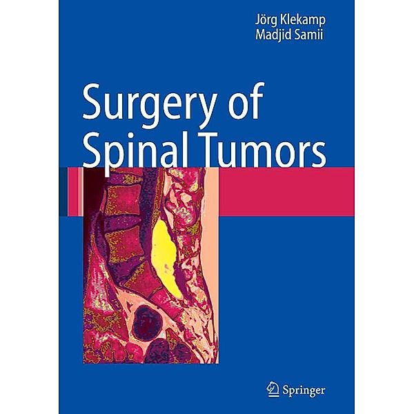 Surgery of Spinal Tumors, Jörg Klekamp, Madjid Samii