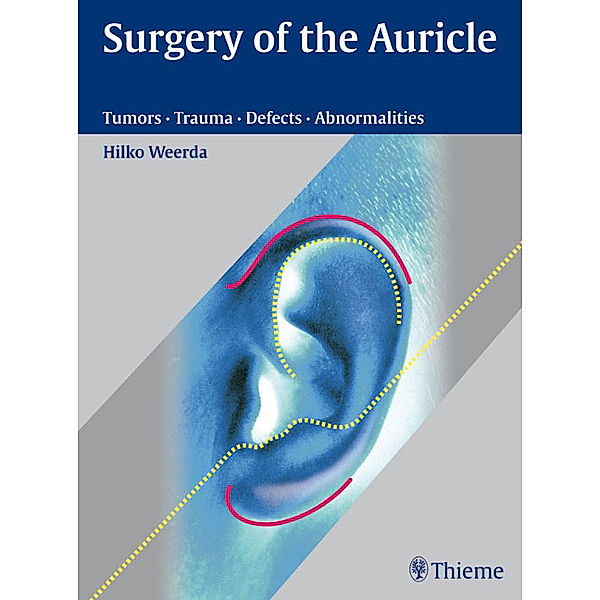 Surgery of the Auricle, Hilko Weerda