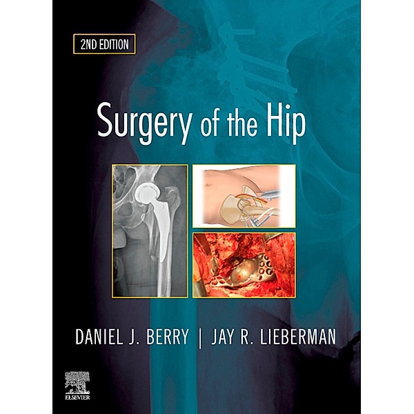 Surgery of the Hip, Daniel J. Berry, Jay Lieberman