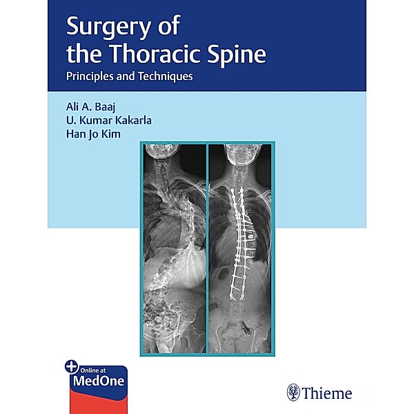 Surgery of the Thoracic Spine, Ali A. Baaj, U. Kumar Kakarla, Han Jo Kim