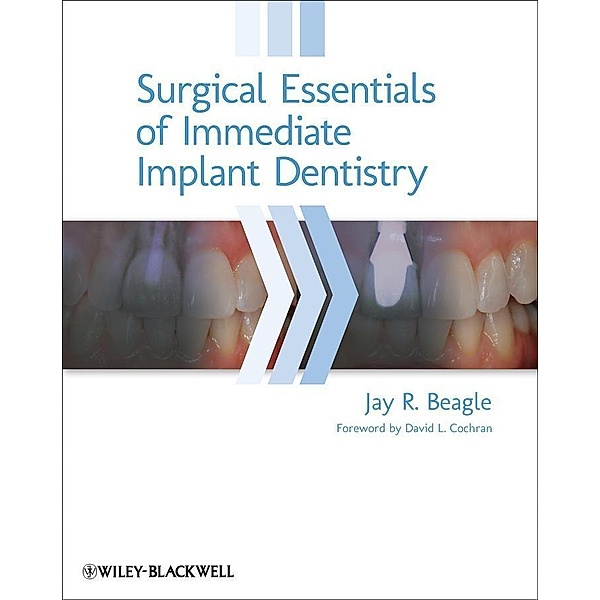Surgical Essentials of Immediate Implant Dentistry, Jay R. Beagle