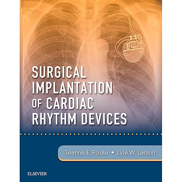 Surgical Implantation of Cardiac Rhythm Devices E-Book, Jeanne Poole, Lyle W. Larson