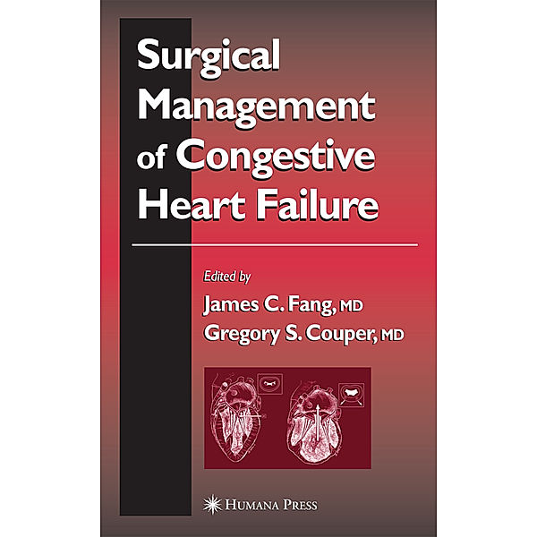Surgical Management of Congestive Heart Failure