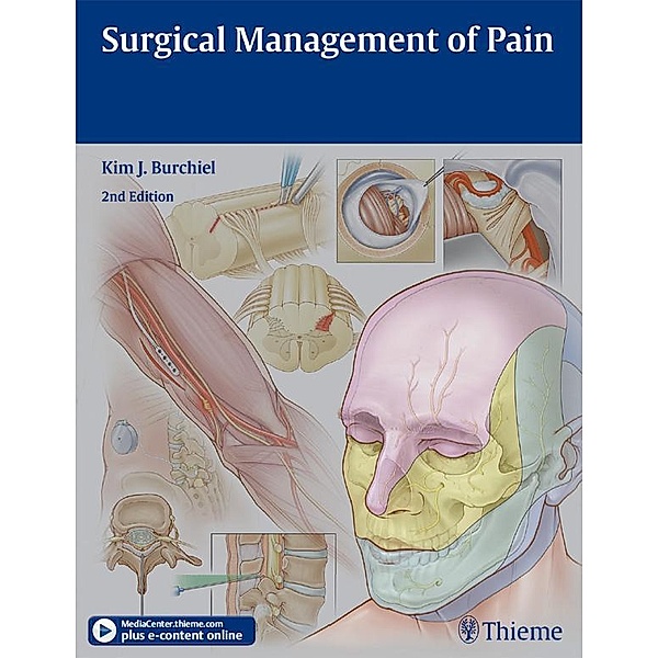 Surgical Management of Pain