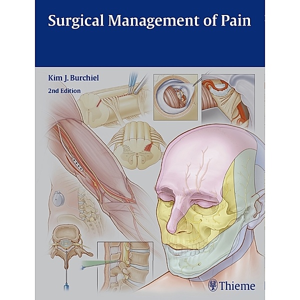 Surgical Management of Pain, Kim J. Burchiel