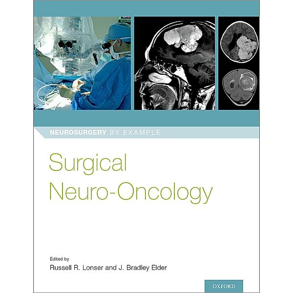 Surgical Neuro-Oncology