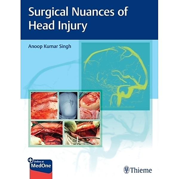 Surgical Nuances of Head Injury, Anoop Kumar Singh