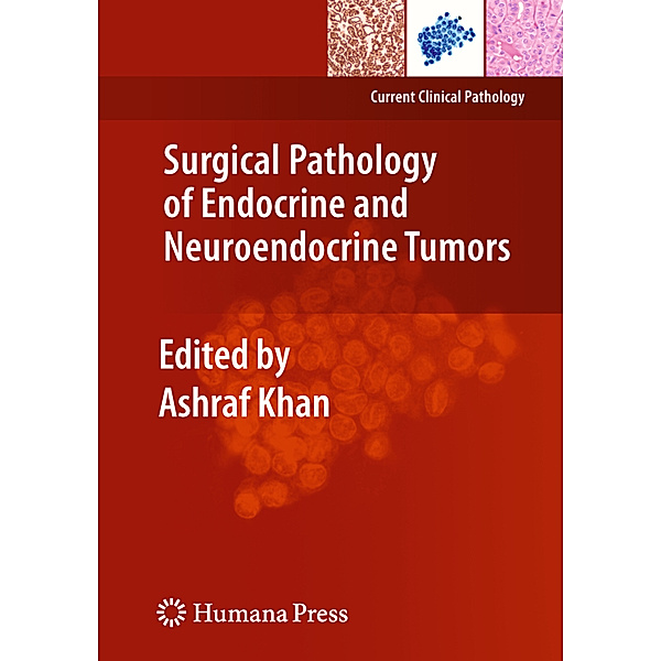 Surgical Pathology of Endocrine and Neuroendocrine Tumors