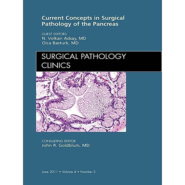 Surgical Pathology of the Pancreas, An Issue of Surgical Pathology Clinics, Volkan Adsay, Olca Basturk