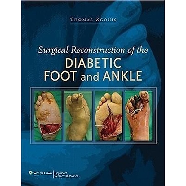 Surgical Reconstruction of the Diabetic Foot and Ankle, Thomas Zgonis