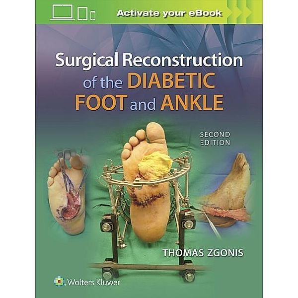 Surgical Reconstruction of the Diabetic Foot and Ankle, Thomas Zgonis