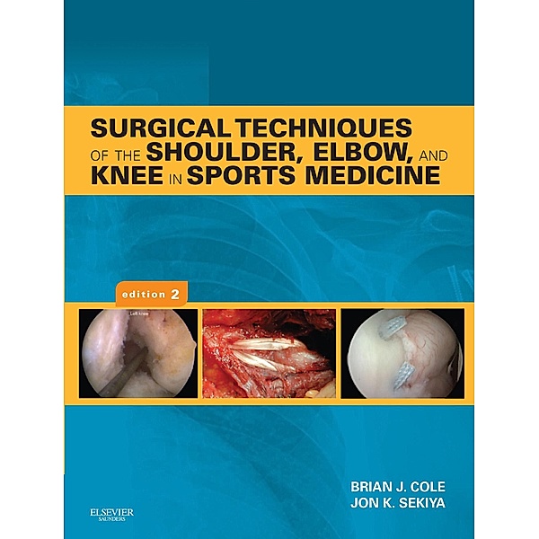 Surgical Techniques of the Shoulder, Elbow and Knee in Sports Medicine E-Book, Brian J. Cole, Jon K. Sekiya