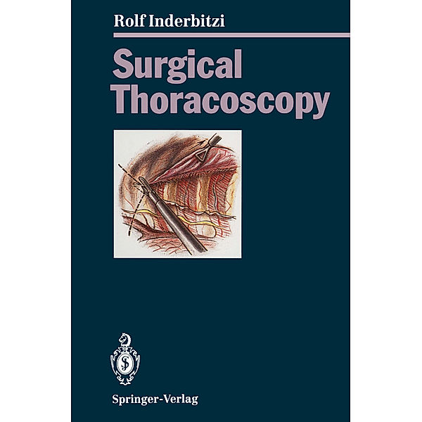 Surgical Thoracoscopy, Rolf G. C. Inderbitzi