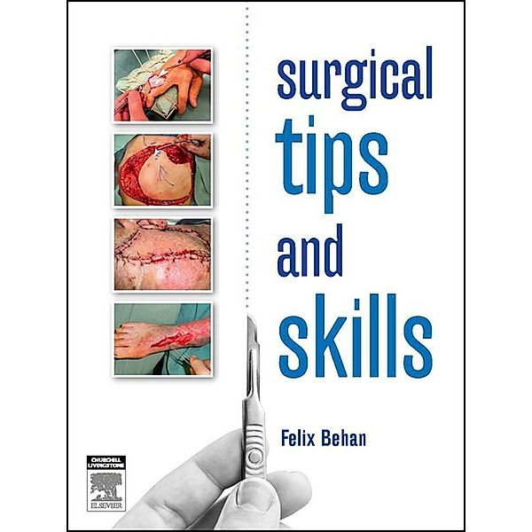 Surgical tips and skills - eBook, Felix Behan