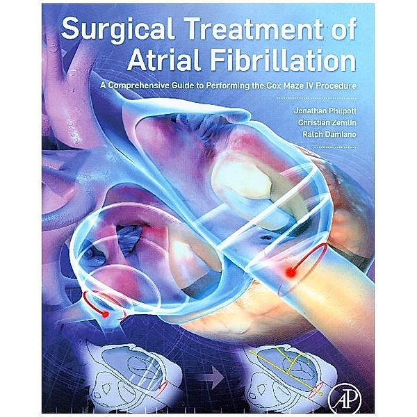 Surgical Treatment of Atrial Fibrillation, Jonathan M. Philpott, Christian Zemlin, Ralph J. Damiano