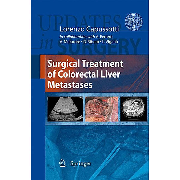 Surgical Treatment of Colorectal Liver Metastases, Lorenzo Capussotti