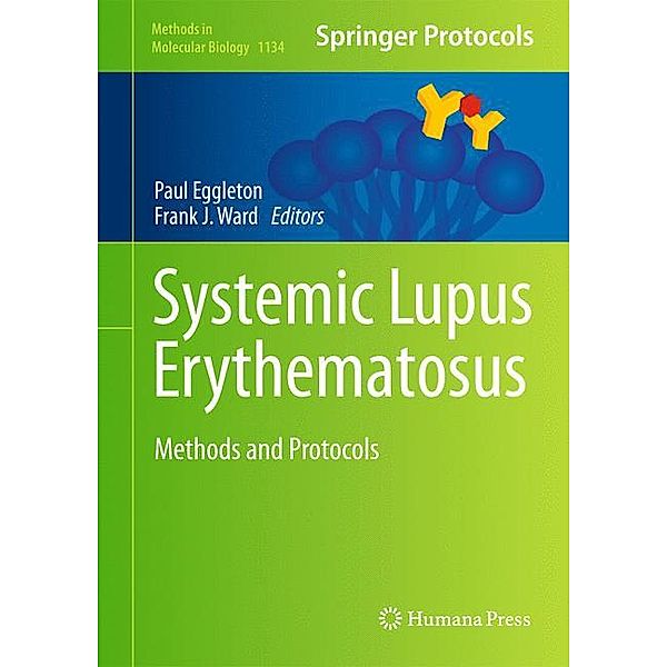 Systemic Lupus Erythematosus