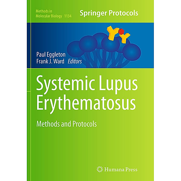 Systemic Lupus Erythematosus