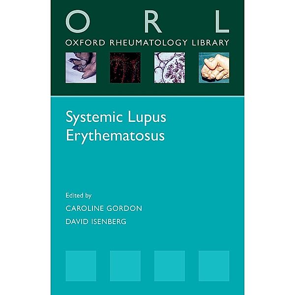 Systemic Lupus Erythematosus / Oxford Rheumatology Library