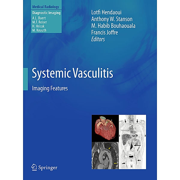 Systemic Vasculitis