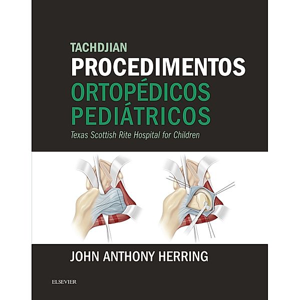 Tachdjian Procedimentos Ortopédicos Pediátricos, John A. Herring