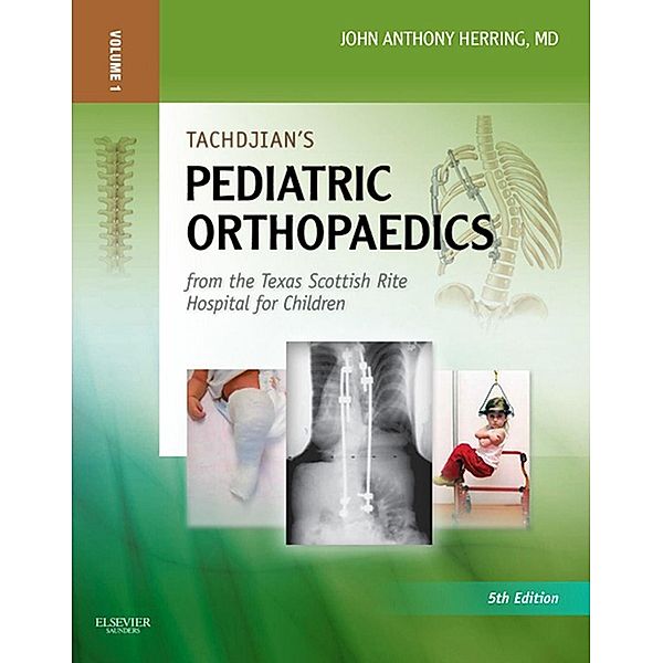 Tachdjian's Pediatric Orthopaedics E-Book, John A. Herring