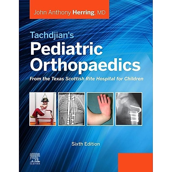 Tachdjian's Pediatric Orthopaedics: From the Texas Scottish Rite Hospital for Children E-Book, John A. Herring