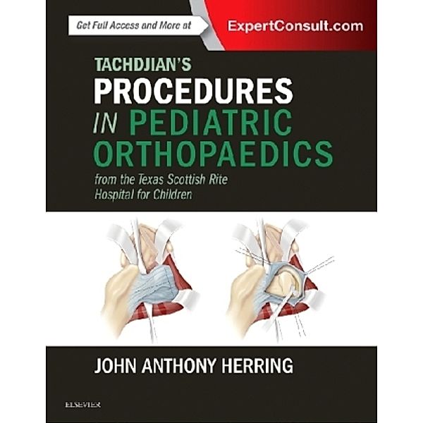 Tachdjian's Procedures in Pediatric Orthopaedics, John A. Herring