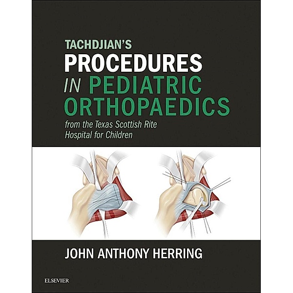 Tachdjian's Procedures in Pediatric Orthopaedics, John A. Herring