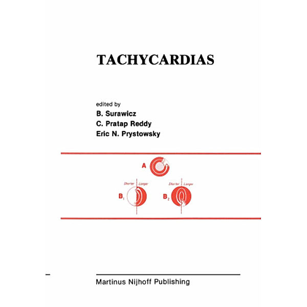 Tachycardias, Surawicz