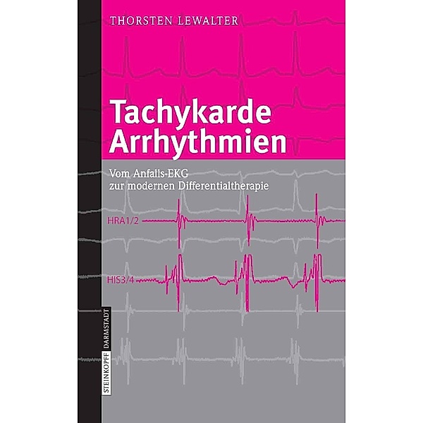 Tachykarde Arrhythmien, Thorsten Lewalter