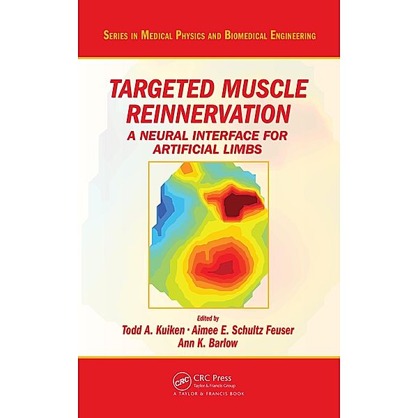 Targeted Muscle Reinnervation