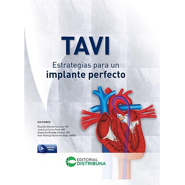 TAVI - Estrategias para un implante perfecto, Ricardo Allende Carrera, José Luis Leiva Pons, Alejandro Ricalde Alcocer, Alan Rodrigo Gutiérrez Vega